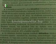 Nincs mitől tartanunk- a lépfene